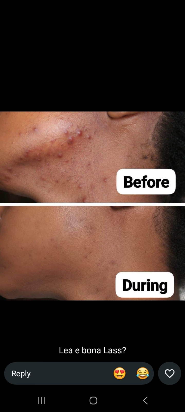 Li sebetsa within a week or 2... u ka se regret ho li sebelisa... ebile haufi we are launching perfu